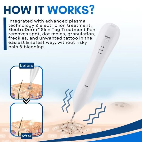 ElectroDerm Skin Tag Treatment Pen