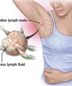 Alternative view of Oveallgo™ Womans Wellness Lymph Care Patch