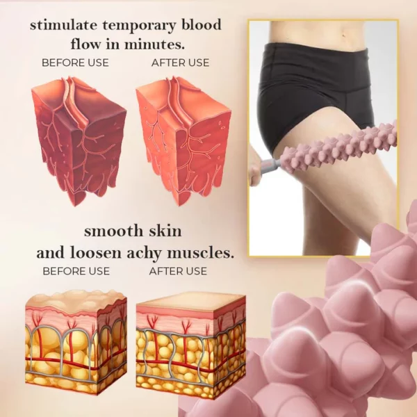 SculptiWave™ Fascia Cellulite Blaster - Image 5