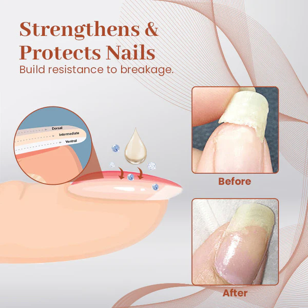 Ceoerty PROStrength Ultimate Nail Repair Serum