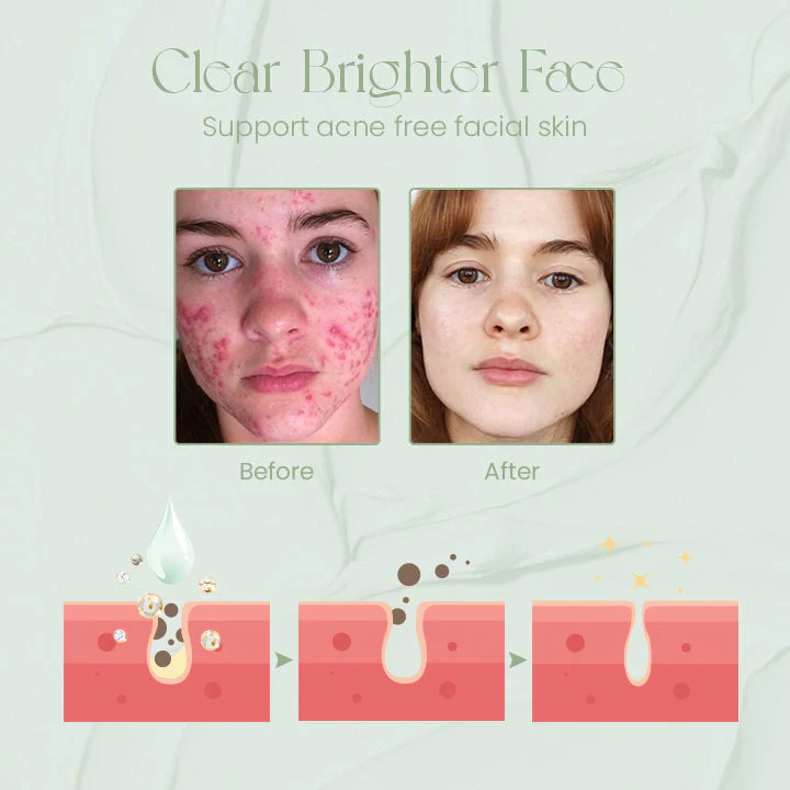 Ceoerty™ ToneTreat Skin Correcting Treatment Cream - Image 7