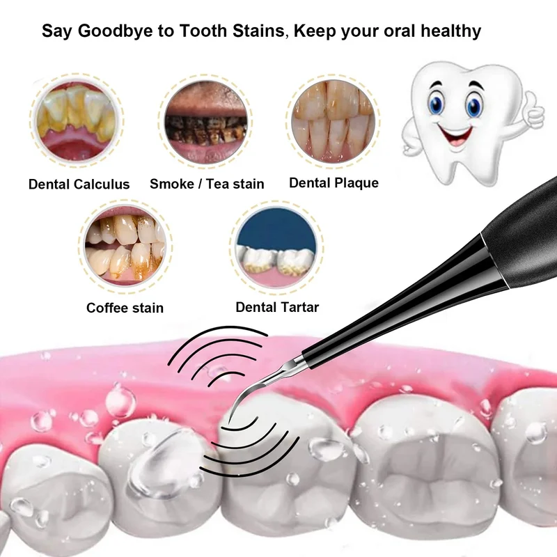 Electric Teeth Cleaner