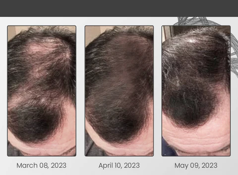 Ceoerty LocksGuard Anti-Hairloss Spray