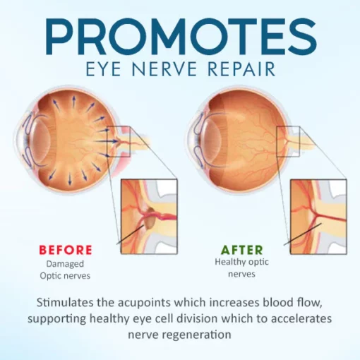 AEXZR Eye Therapy Patch
