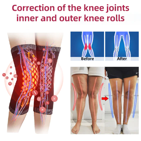 COLORIVER Honeycomb Ionic Lymphatic Detox Self-Heating Knee Support