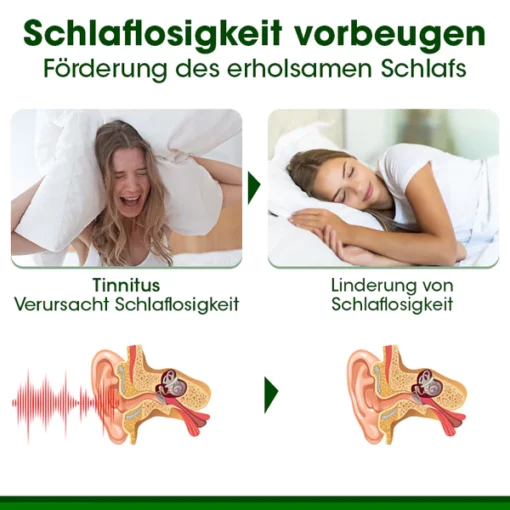 Biancat™ RingAway Olivenblatt Tinnitus-Creme - Image 5