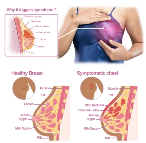 Sugoola Sizeup Pain Relief Acupoint Chest Patch