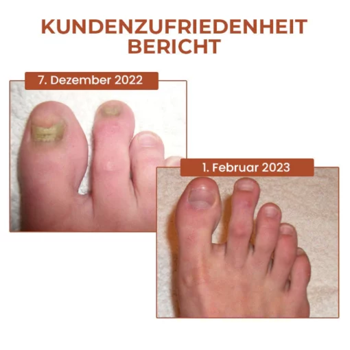 Fivfivgo 7 Tage Maximale Strke Nagel-Reparatur-Serum