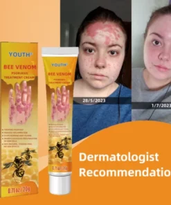 EdiJonah® Bee Venom Psoriasis Treatment Cream PRO