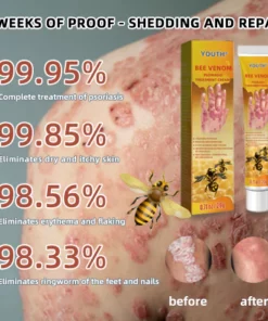 Alternative view of EdiJonah® Bee Venom Psoriasis Treatment Cream PRO