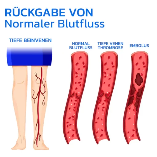 GFOUK Varizen Behandlungspflaster