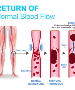 Alternative view of PZGONE® Radiofrequency Herbal Thermal Knee Support