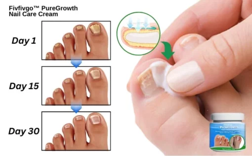 Fivfivgo PureGrowth Nail Care Cream