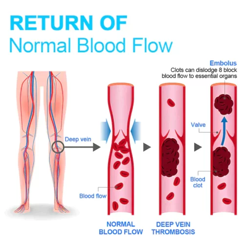 RFMediTherm Radiofrequency Herbal Thermal Knee Support