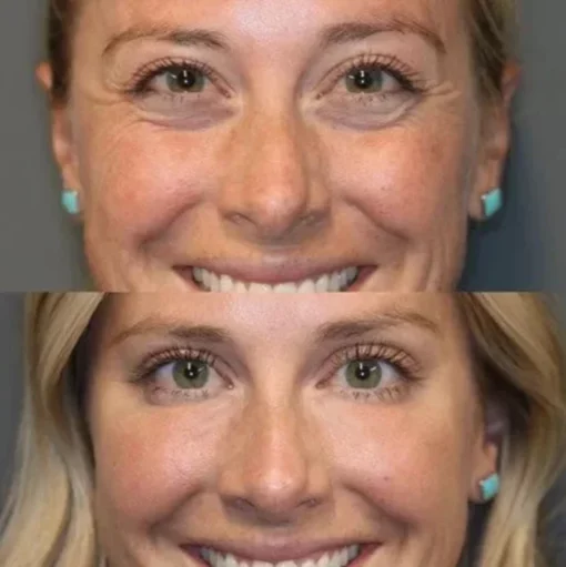CËLYN Instant FIRM Eye Tightener - Image 3