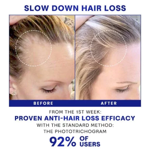 BlusomsTM Densifique HairGrowth Formula Serum Spray - Ofbylding 4
