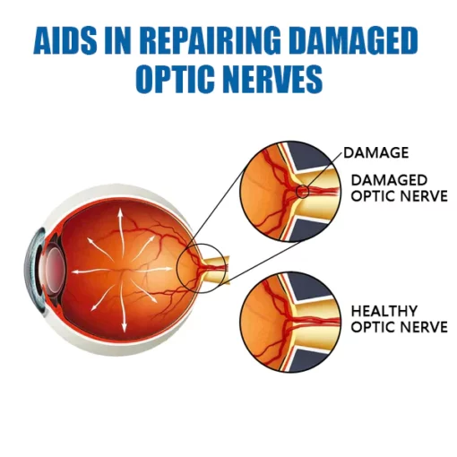 Ourlyard Eye drops for treating vision issues