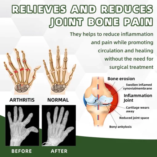 Cvreoz Australian Bee Venom Pain and Bone Healing Balm