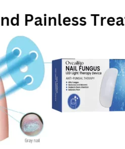 Alternative view of Oveallgo™ ProX Revolutionary Light Therapy Device For Toenail Diseases