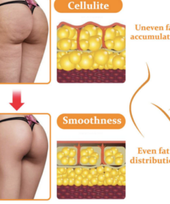 Alternative view of Fivfivgo™ EMS Gesäßstraffungsmassagegerät