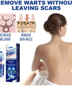 Alternative view of Jusbj™ WartsOff Instant Blemish Removal Cream