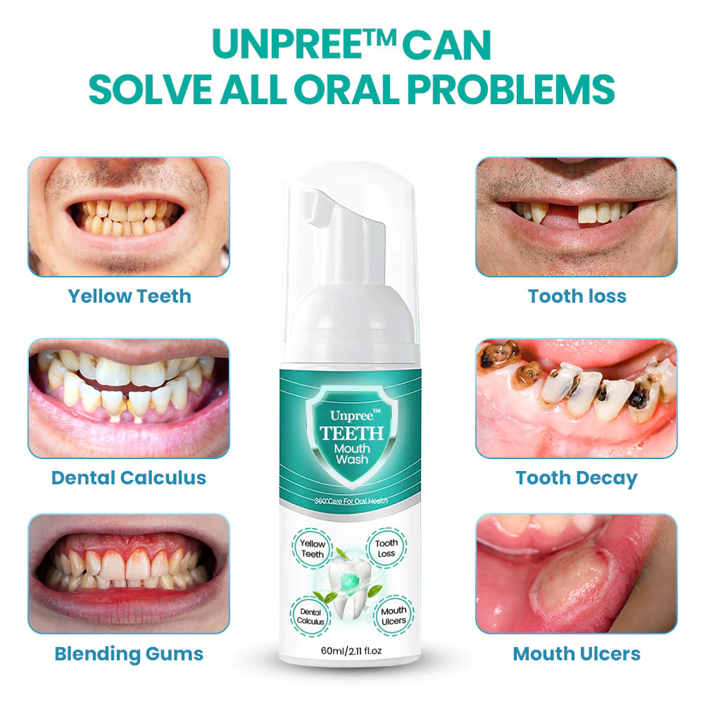 UNPREE TEETH Mouthwash  Solve all Oral Problems