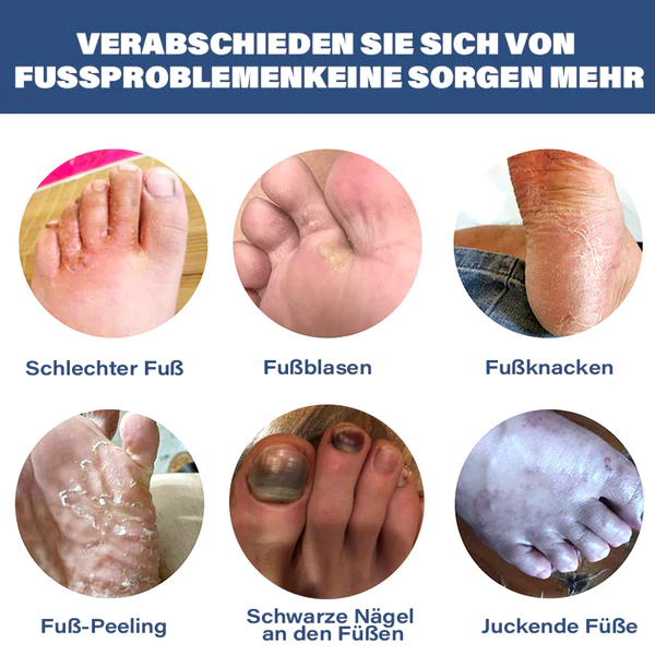 Furzero Medizinisches Nagelpilz-FuAspray