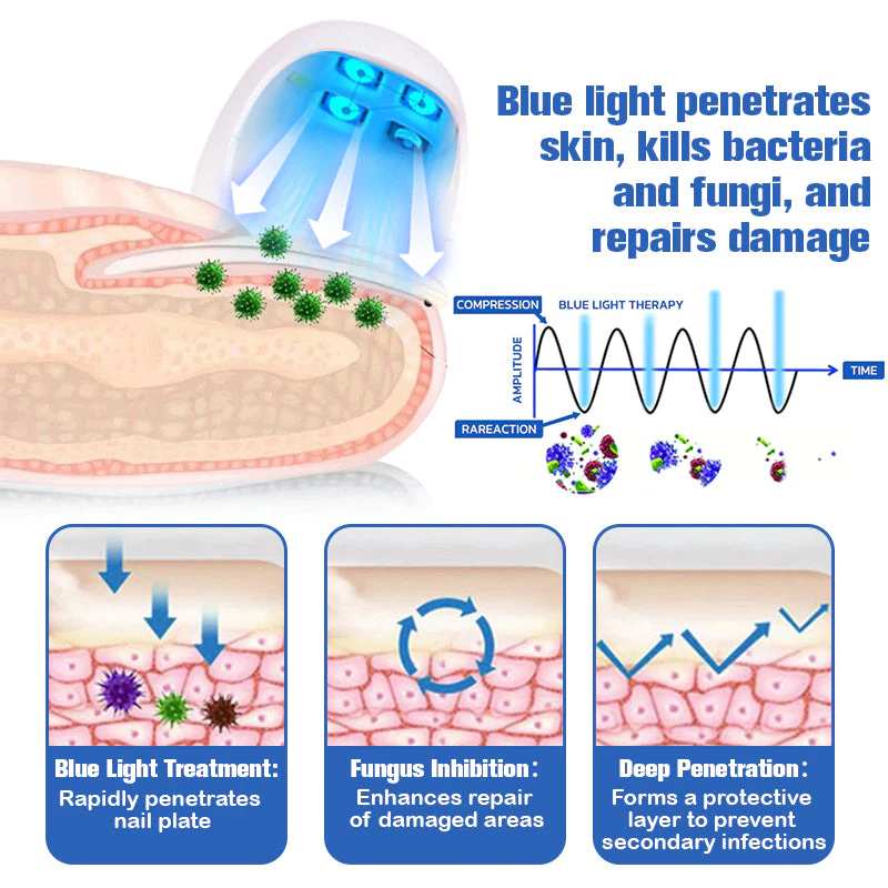 Furzero Nail Fungus Cleaning Laser Relief Device