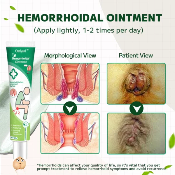 Ourlyard Hemorrhoidal Ointment