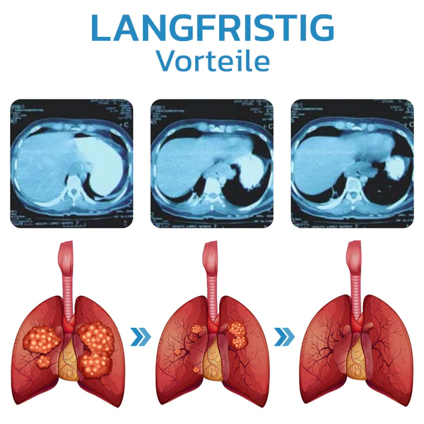GFOUK EasyBreath Lungenreinigungsger