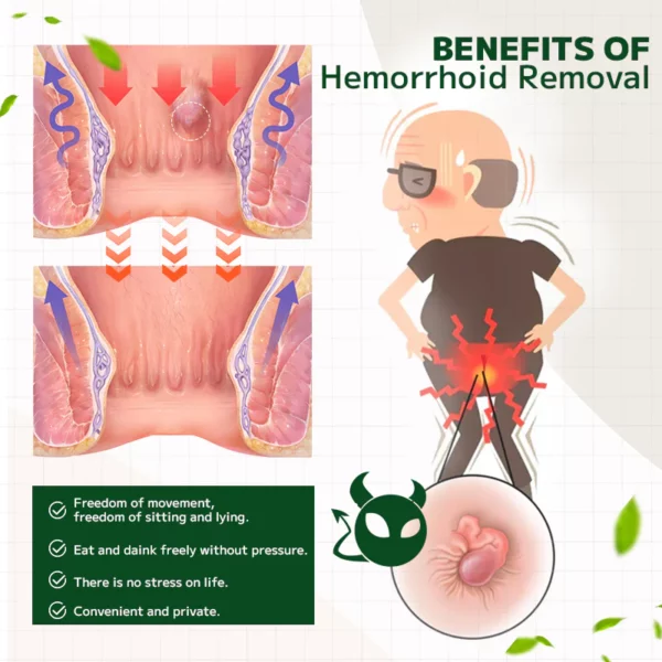 Ourlyard Hemorrhoidal Ointment