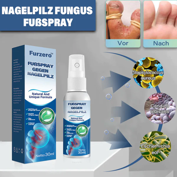 Furzero Medizinisches Nagelpilz-FuAspray