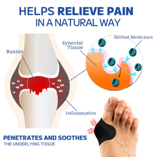 Lotmay™ Bunion Pain Relief Patch - Ofbylding 7