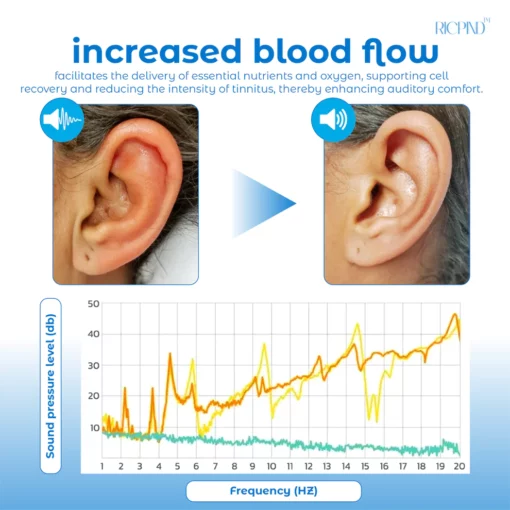RICPIND Tinnitus NerveTreat Infrared Thermal Pen - Kuva 3