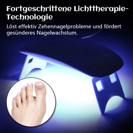 Biancat PediBeam Zehennagel Lichttherapieger