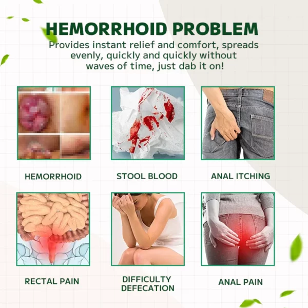 Ourlyard Hemorrhoidal Ointment