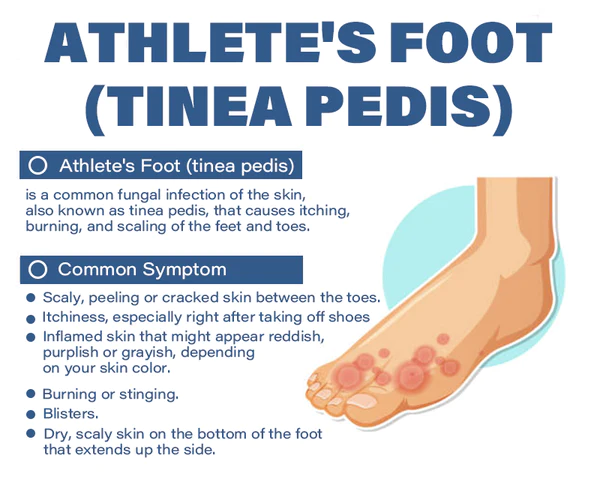 Furzero Medizinisches Nagelpilz-FuAspray