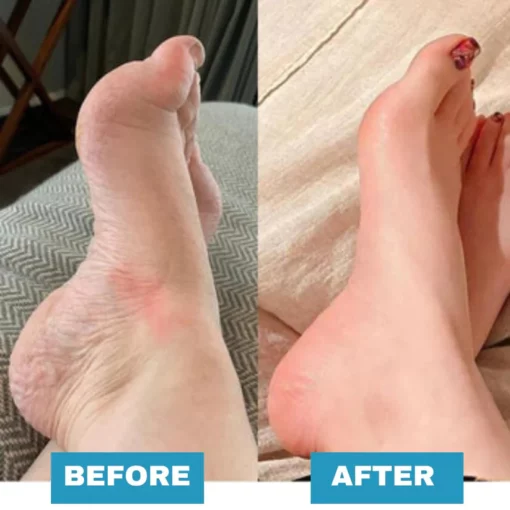 Foot Massager For Lasting Foot Pain Relief