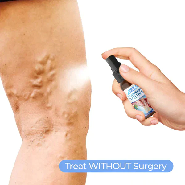 Lovild Varicose Veins Spray