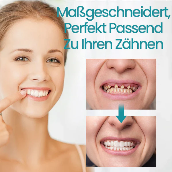 Ceoerty Verstellbare Schnallenprothesen