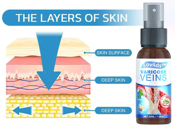 Lovild Varicose Veins Spray