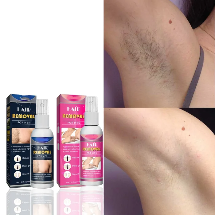 Body Hair Removal Spray - Image 9