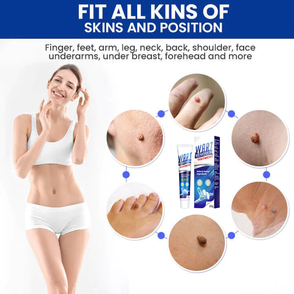 Lovilds Instant Blemish Removal Cream