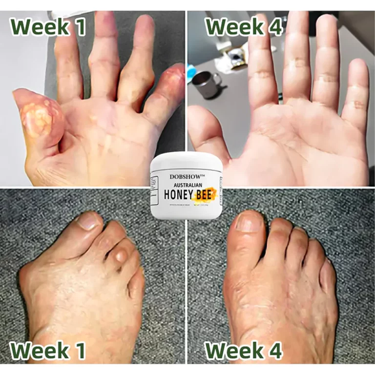 Dobshow™ Pain and bone healing cream with Australian honey bee venom - Image 5