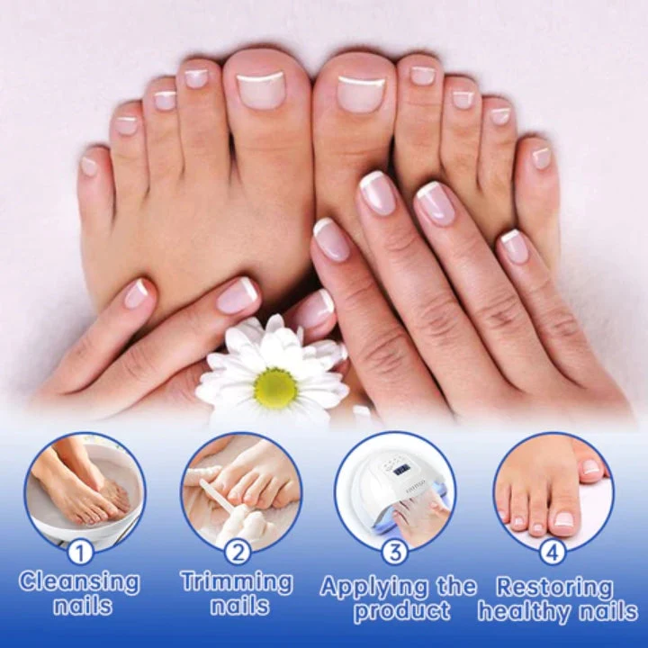 Fivfivgo™ PureNail Fungus Laser Therapie Gerät - Image 5