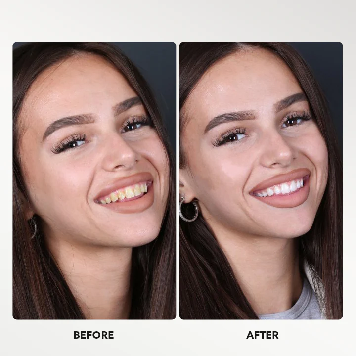 Pùdar gealachaidh fiaclan LIMETOW ™ - Ìomhaigh 6