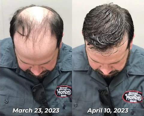 Oveallgo™ Jamaican Black Castor Oil - Image 8