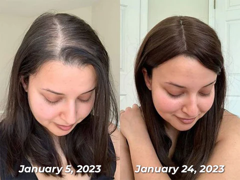 Oveallgo™ Jamaican Black Castor Oil - Image 7