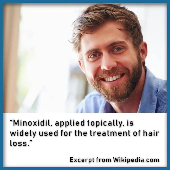 Minoxidil Strands Hair Growth Spray