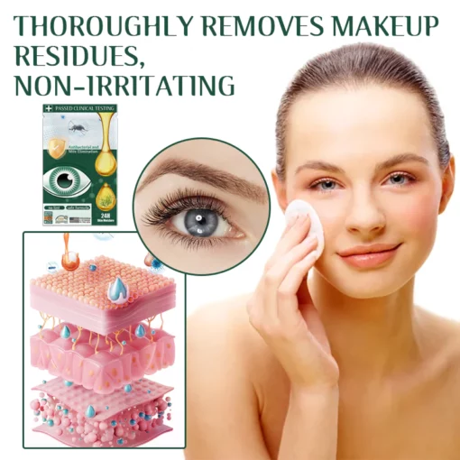 Fivfivgo™ Tea Tree Terpineol Wipes foar it fuortheljen fan oogmyten - ôfbylding 7